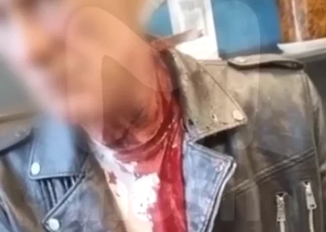 ВИДЕО: мужчина с ножом в шее зашел в бар со словами "нормально все"