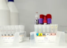 Несмотря на риск, что с 1 августа этого года Centrālā laboratorija могла прекратить оказание оплачиваемых государством услуг, до сих пор этого не произошло. 