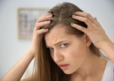 Young woman with hair loss problem indoors