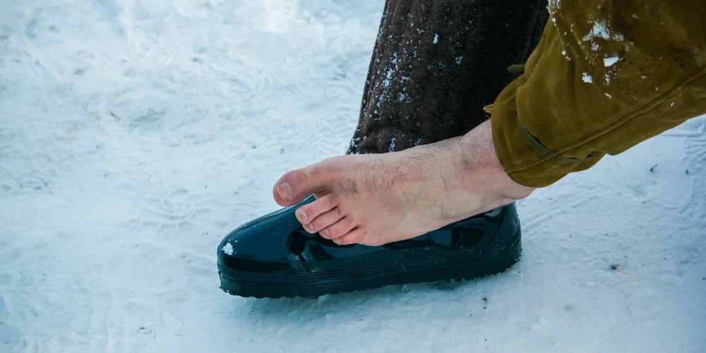 В больницы поступают люди с обморожениями; двоим придется ампутировать пальцы ног