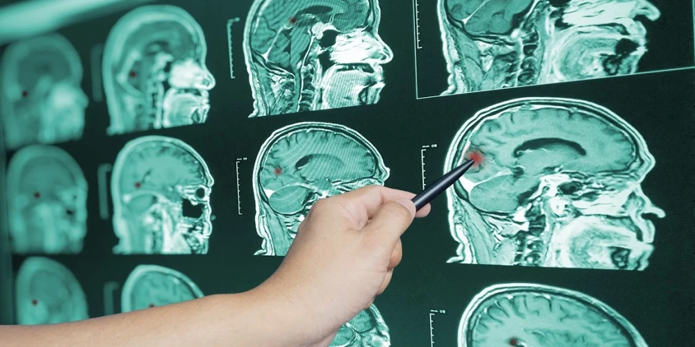 Zinātnieki atklāj aizraujošu informāciju par cilvēka smadzenēm