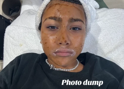 Норт Уэст делает процедуру для лица.