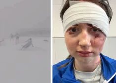 "Это был ужас, просто мясорубка": на соревновании в России случился массовый завал лыжниц с травмами и переломами