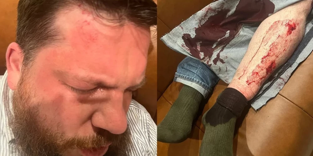 На соратника Навального напали у его дома в Вильнюсе - его избили молотком