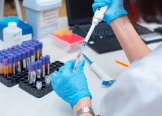 Zinātnieki apgalvo, ka spēj "izņemt" HIV vīrusu no inficētajām šūnām