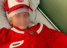 Ребенок, которого сбили бежавшие на машине из "Крокуса" террористы, все еще в больнице