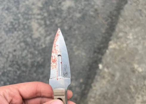 Krievu neonacists lielās ar auss nogriešanā izmantoto nazi (ekrānuzņēmums no "X")