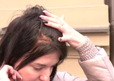 Посиделки закончились травмой - в рижском баре на голову посетительницы упала колонка
