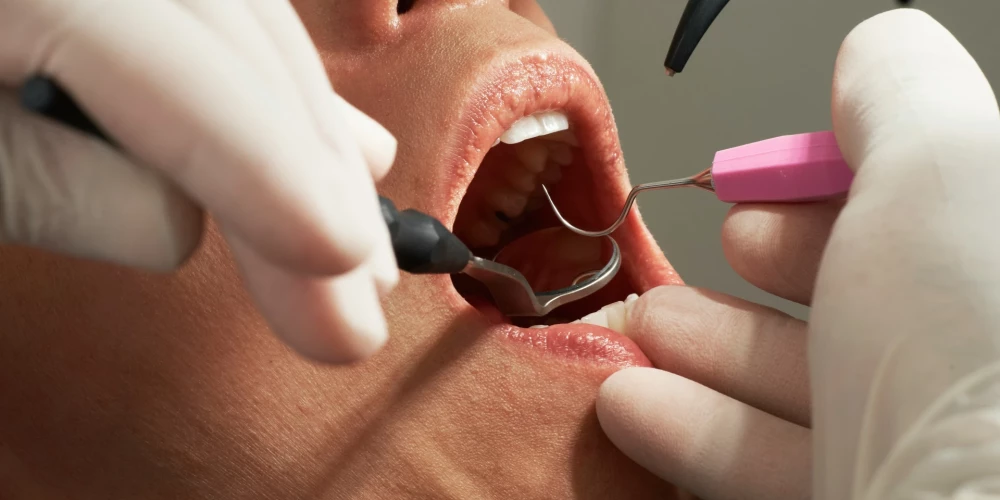 Krasi pieaugusi iedzīvotāju neapmierinātība ar zobārstniecības pakalpojumiem