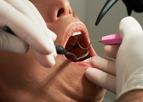 Krasi pieaugusi iedzīvotāju neapmierinātība ar zobārstniecības pakalpojumiem