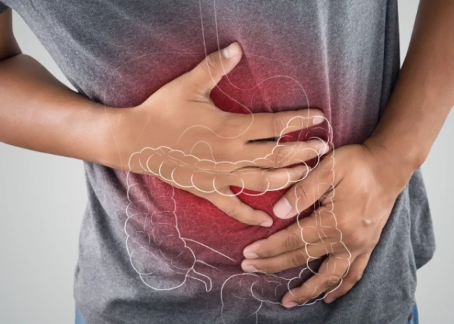 Palīgā, aizcietējums! Kā izvairīties no sāpīgām un nepatīkamām zarnu problēmām