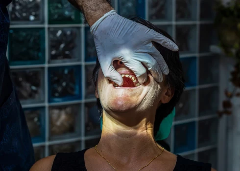 В Турции стоматолог едва не повредил мозг пациента имплантом; новость прокомментировал латвийский врач