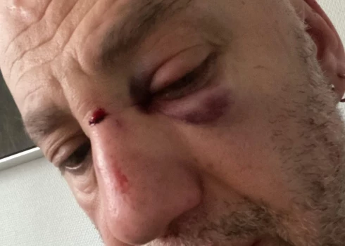 Cietušais mūziķis Horens Stalbe (foto no privātā arhīva)