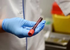 Austrumu slimnīcā bez maksas varēs veikt HIV testu