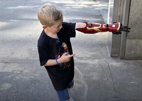 Piecgadnieks, iespējams, kļuvis par jaunāko bērnu ar bionisko supervaroņa roku