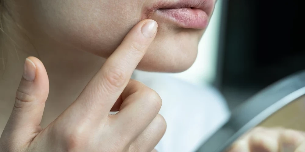 Летом следует выбирать бальзам для губ, который не только увлажняет, но и защищает от солнца.