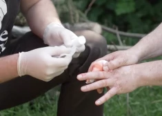 VIDEO: speciālisti skaidro, kā rīkoties, ja nogriezts pirksts