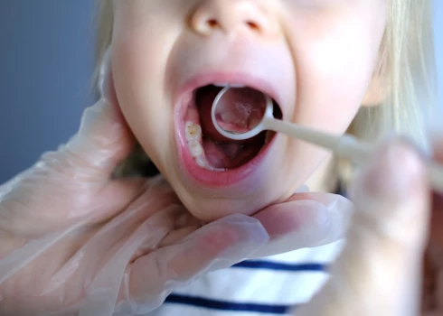 Latvijas attālākajos pagastos bērniem nodrošinās mobilās zobārstniecības pakalpojumus
