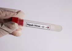 Indijā atkārtoti izplatās nāvējošais Nipahas vīruss
