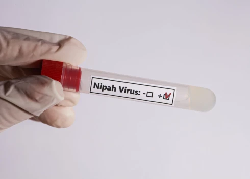 Indijā atkārtoti izplatās nāvējošais Nipahas vīruss
