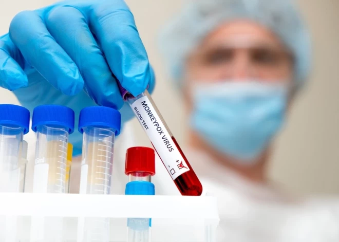 Arī Pakistānā reģistrē šogad pirmo pērtiķu baku saslimšanas gadījumu