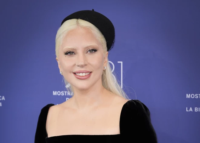 Lady Gaga vairs necieš no slimības, kas viņai radīja sāpes no galvas līdz kājām