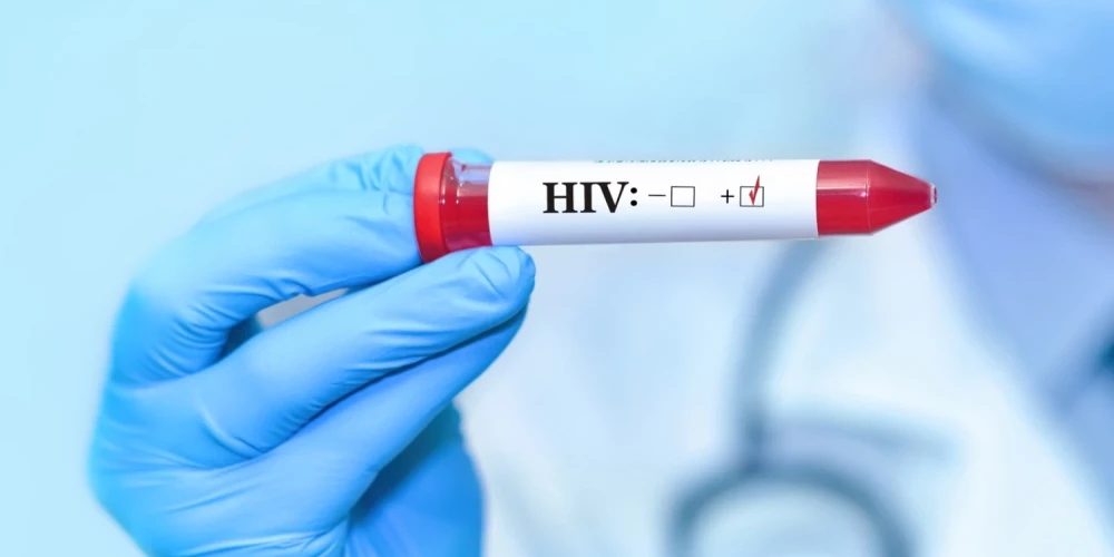 Pašlaik Latvijā ap 30% HIV inficēto nav informēti par savu statusu. 