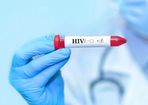 Pašlaik Latvijā ap 30% HIV inficēto nav informēti par savu statusu. 