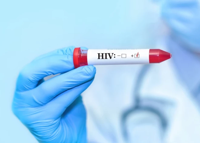 Trešdaļa HIV inficēto Latvijā neapzinās savu stāvokli