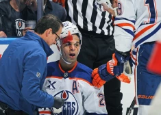 TORONTO, CANADA - NOVEMBER 16: Darnell Nurse #25 of the Edmonton Oilers shows the effects of a hit from Ryan Reaves #75 of the Toronto Maple Leafs during the second period in an NHL game at Scotiabank Arena on November 16, 2024 in Toronto, Ontario, Canada.   Claus Andersen/Getty Images/AFP (Photo by Claus Andersen / GETTY IMAGES NORTH AMERICA / Getty Images via AFP)