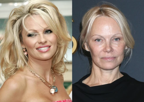 Памела Андерсон раньше и сейчас.