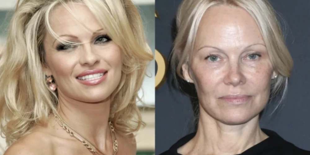 Pamela Andersone iepriekš un tagad.