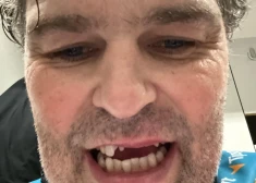 Jaromirs Jāgrs nezaudē humora sajūtu pat pēc tādas traumas (foto: Jaromir Jagr / "Facebook")