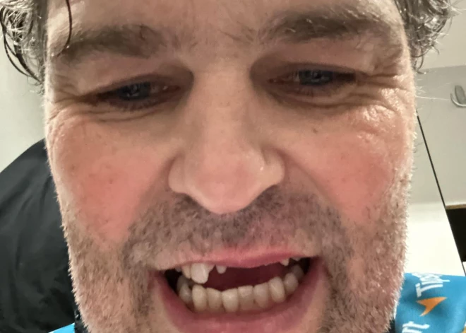 Čehu hokeja leģendai Jaromīram Jāgram spēles laikā izsit četrus zobus, viņš sajūsmina fanus ar asprātīgu komentāru