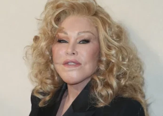 Знаменитая жертва пластики, "женщина-кошка" Джослин Вильденштейн, умерла в 84 года