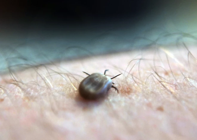 Šogad RAKUS stacionāros pacientiem noņemtas sešas ērces