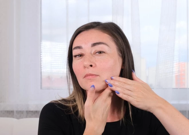 Vai tu lieto alkoholu? Pazīmes, kā tas ir redzams tavā sejā