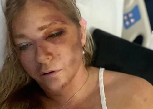 Virdžīnija Džufre slimnīcā (ekrānuzņēmums no "Instagram")