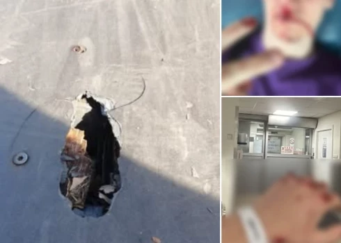 Ar izsistiem zobiem trešdien kādam ķekavietim beidzās izklaides vietējā skeitparkā.