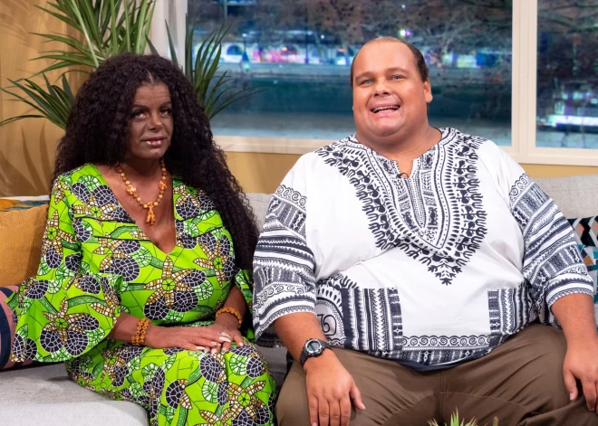 Vācu pāris nolemj mainīt ādas krāsu uz melnu