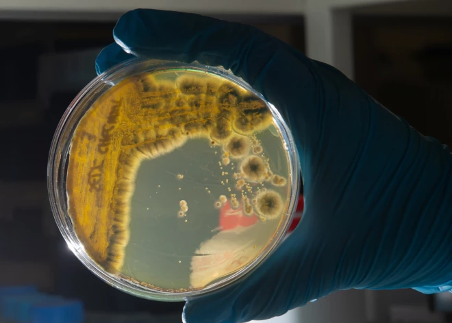 Может ли опасная кишечная инфекция охватить всю Латвию - мнение специалиста