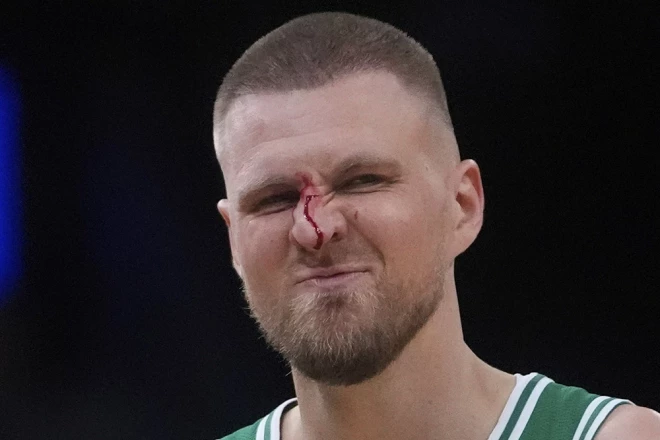 Kristaps Porziņģis pēc sāpīgā incidenta nezaudēja smaidu.