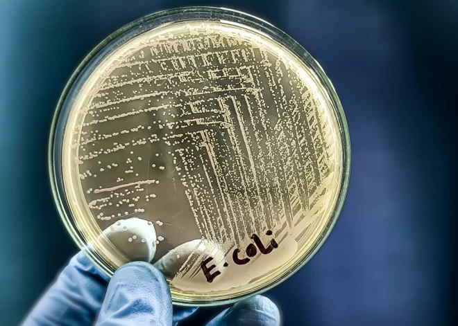 Līdz šim atklāti vismaz divi iespējamie E. coli infekcijas avoti