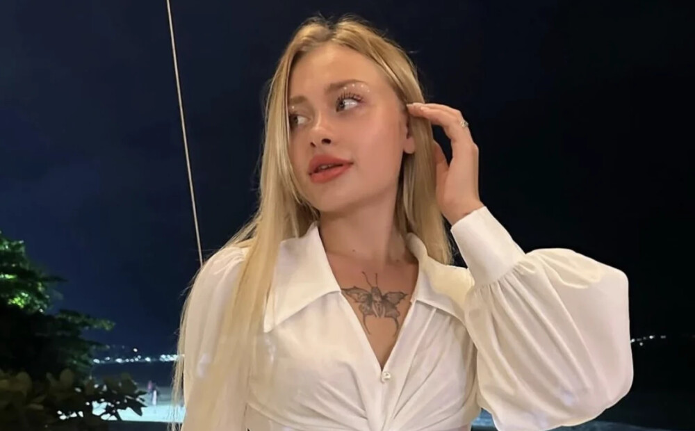 Zobi salikti "Birkin" somā: kādā stāvoklī šobrīd ir Dubaijā smagi savainotā ukraiņu modele