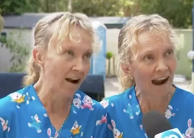 Идентичные близнецы поразили зрителей по всему миру: такого никто не ожидал!