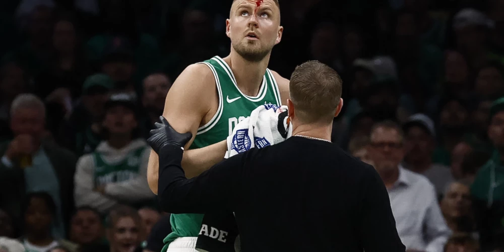 Kristapa piere pamatīgi asiņoja. Jāatgādina, ka šī aprīļa laikā bija otrā reize, ka latvieša seja spēles laikā bija asinīs. Iepriekš pēc Kodija Mārtina sitiena spēlē pret Šarlotas "Hornets" Kristaps pārsita degumu.