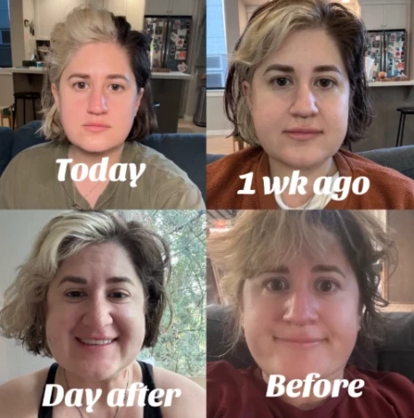 Mikeilas pārvērtības.