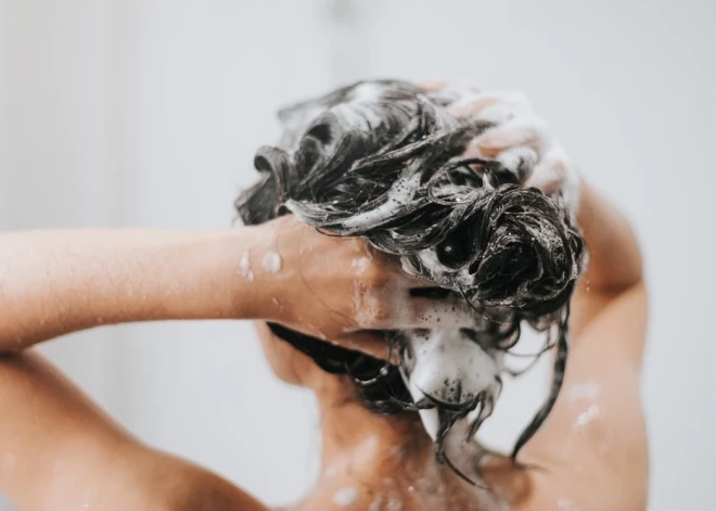 Перхоть, зуд и шелушение: что делать и какие шампуни выбирать