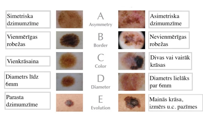 Ķermeņa pārbaudīšana pēc ABCDE metodes.