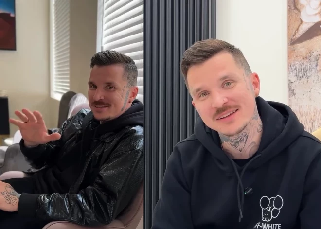 Miks Dukurs izlēmis atbrīvoties no sejas tetovējumiem